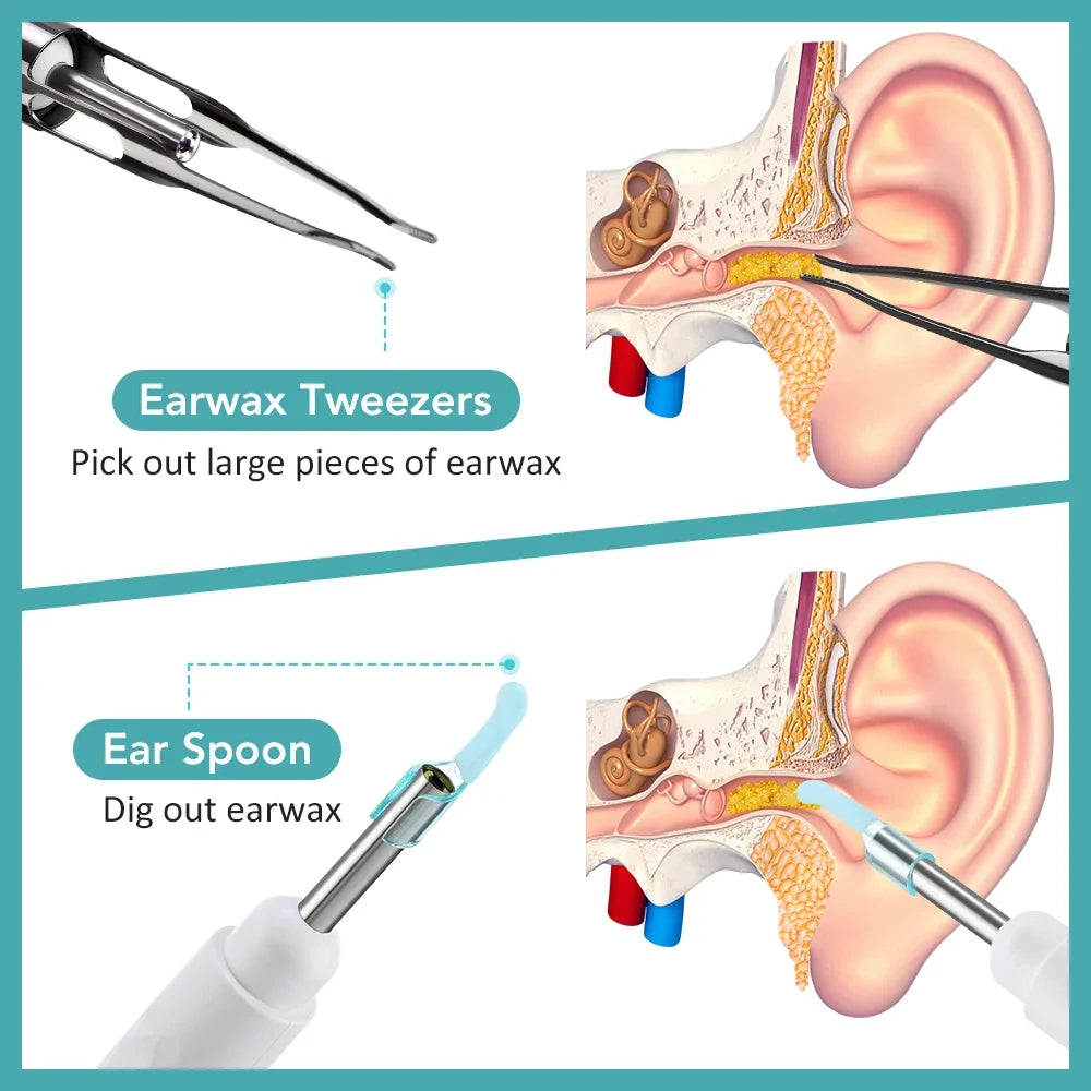 Visual Ear Wax Removal Tool with 1080P Camera & Tweezers