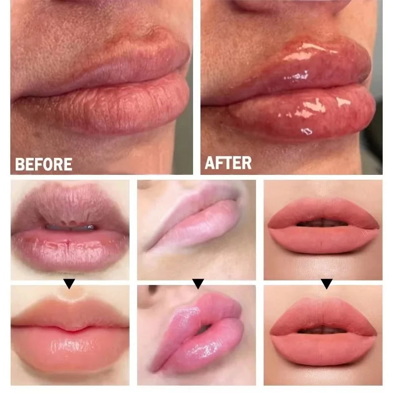 Eelhoe Lip Plumper Oil – Volumising, Moisturizing & Nourishing Lip Plumper Oil Oasis Select