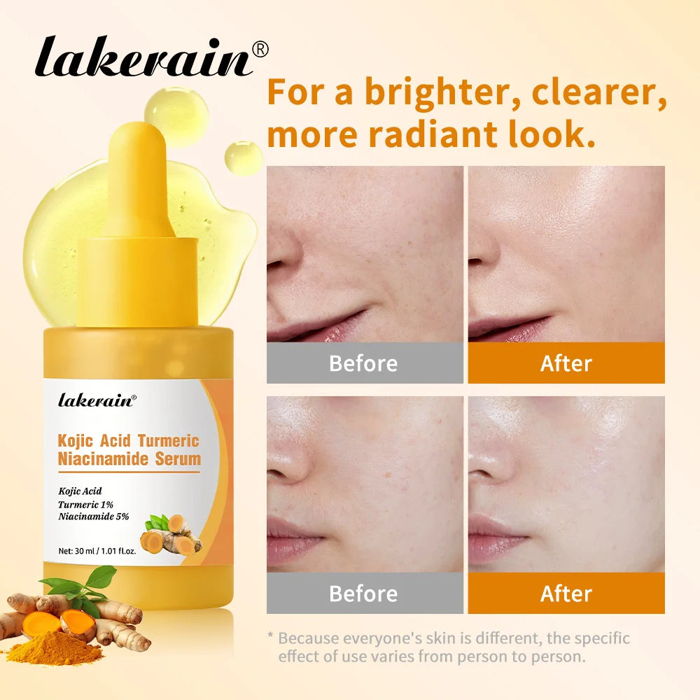 Kojic Acid Turmeric Niacinamide Serum Precise Dropper Design Deep Moisturizing Soothe Skin Brighten Skin Tone Facial Care Oasis Select