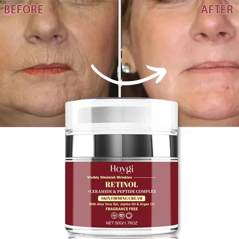 Retinol Face Cream – Firming, Brightening & Moisturizing 50g