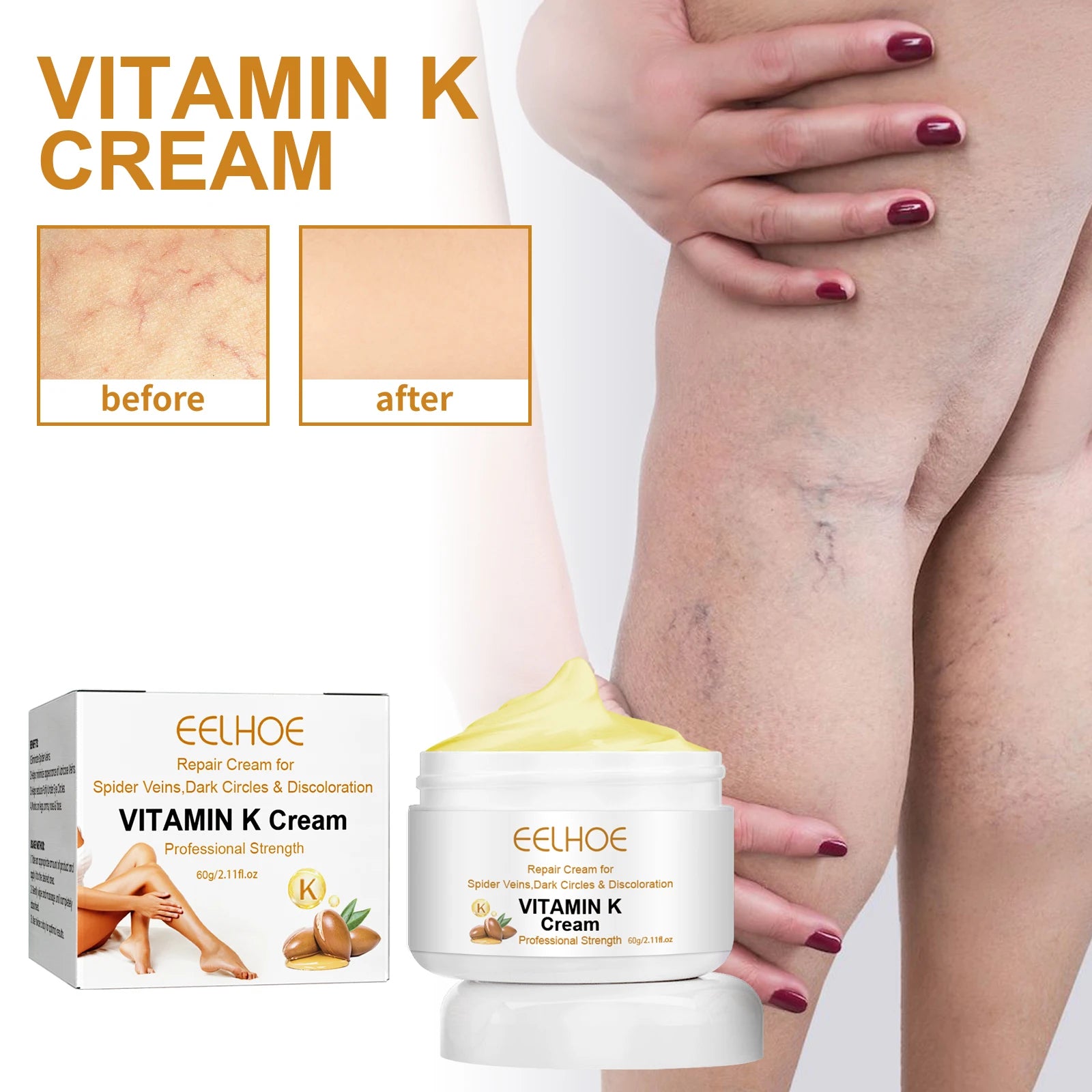 Vitamin K Cream Effective Varicose Vein Relief Cream Massage Care Relieve Leg Soreness Swelling Phlebitis Spider Pain Ointment Oasis Select