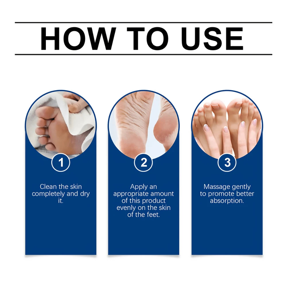 SUYARUN 60% Urea Foot Cream for Cracked Heels & Dry Skin - Intensive Moisturizing Treatment, Callus Remover, Diabetic Foot Care. Oasis Select
