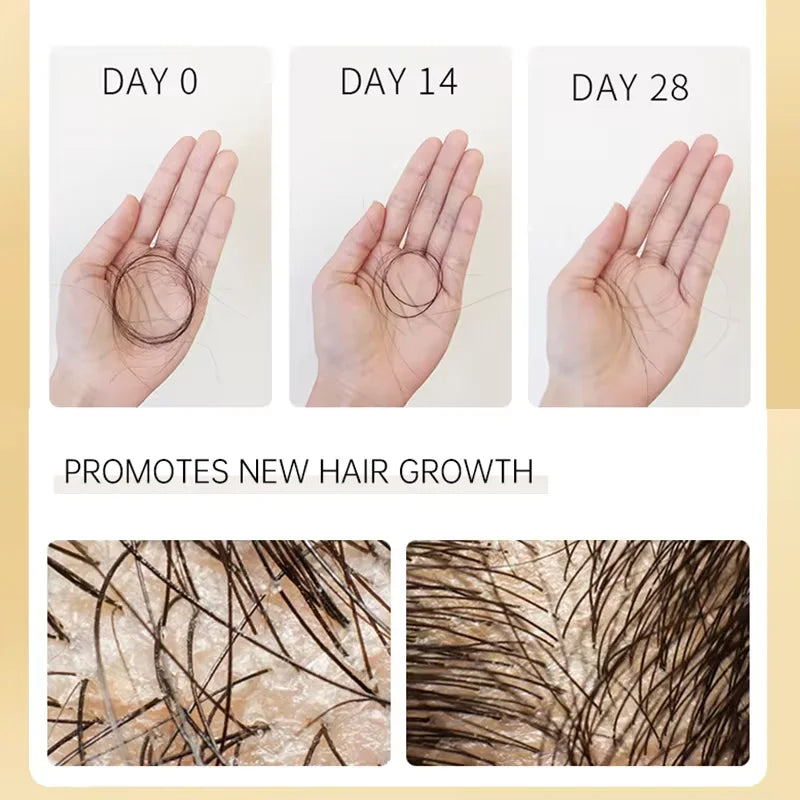 Biotin Prevent Hair Loss Shampoo And Conditioner Growth Oil Treatment For Hair Fast Regrowth Care Beard Hair Beauty Health Care Oasis Select