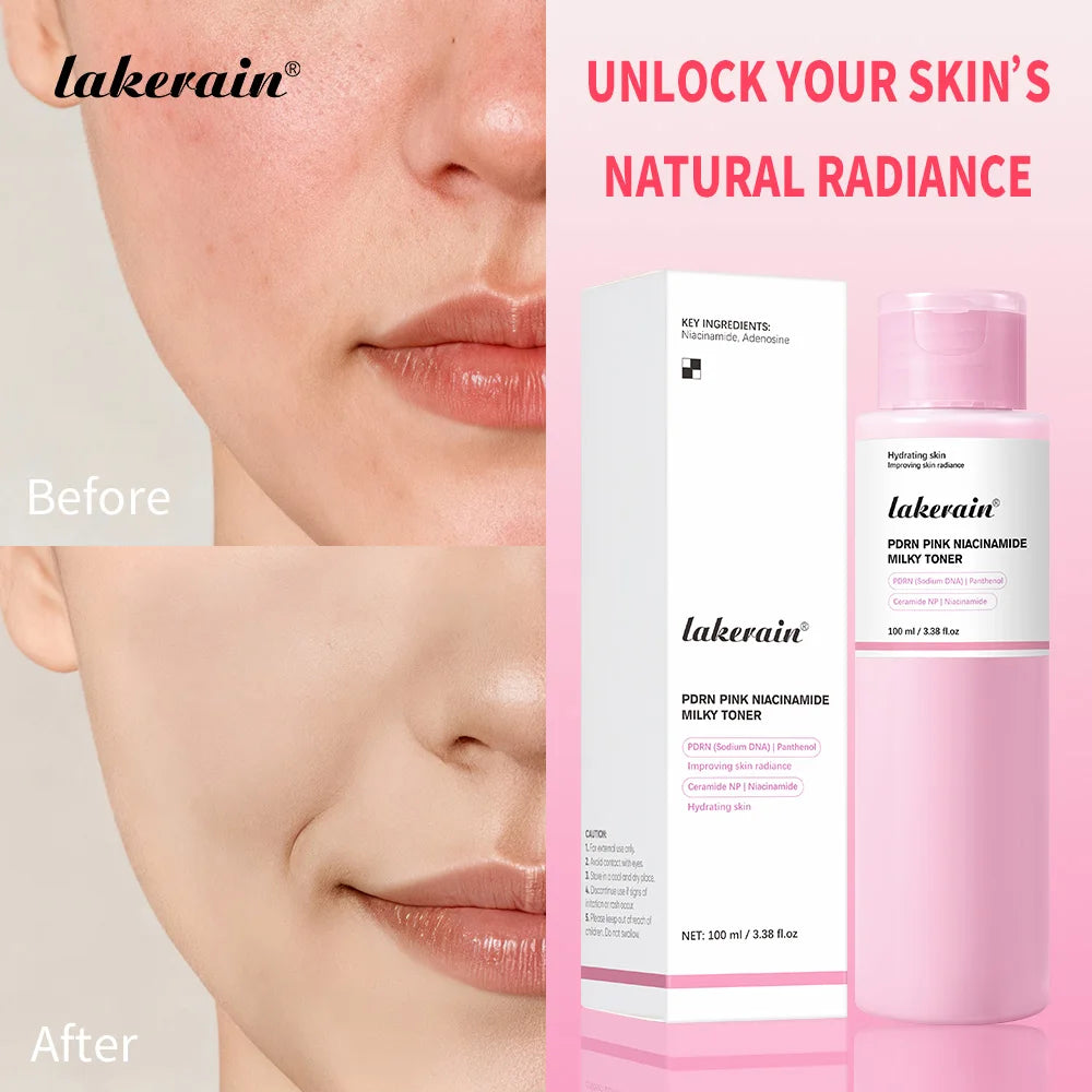 Pink Niacinamide Milky Toner Long-lasting Hydration Even Skin Tone Quickly Absorbed Achieve Dewy Glass Skin Daily Milky Toner Oasis Select