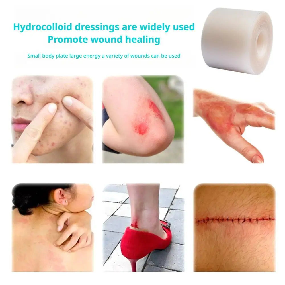 Hydrocolloid Roll Wound Care Bandage For Wet Healing Self-Adhesive Invisible Cuttable Waterproof Patch For Pressure Sores Oasis Select