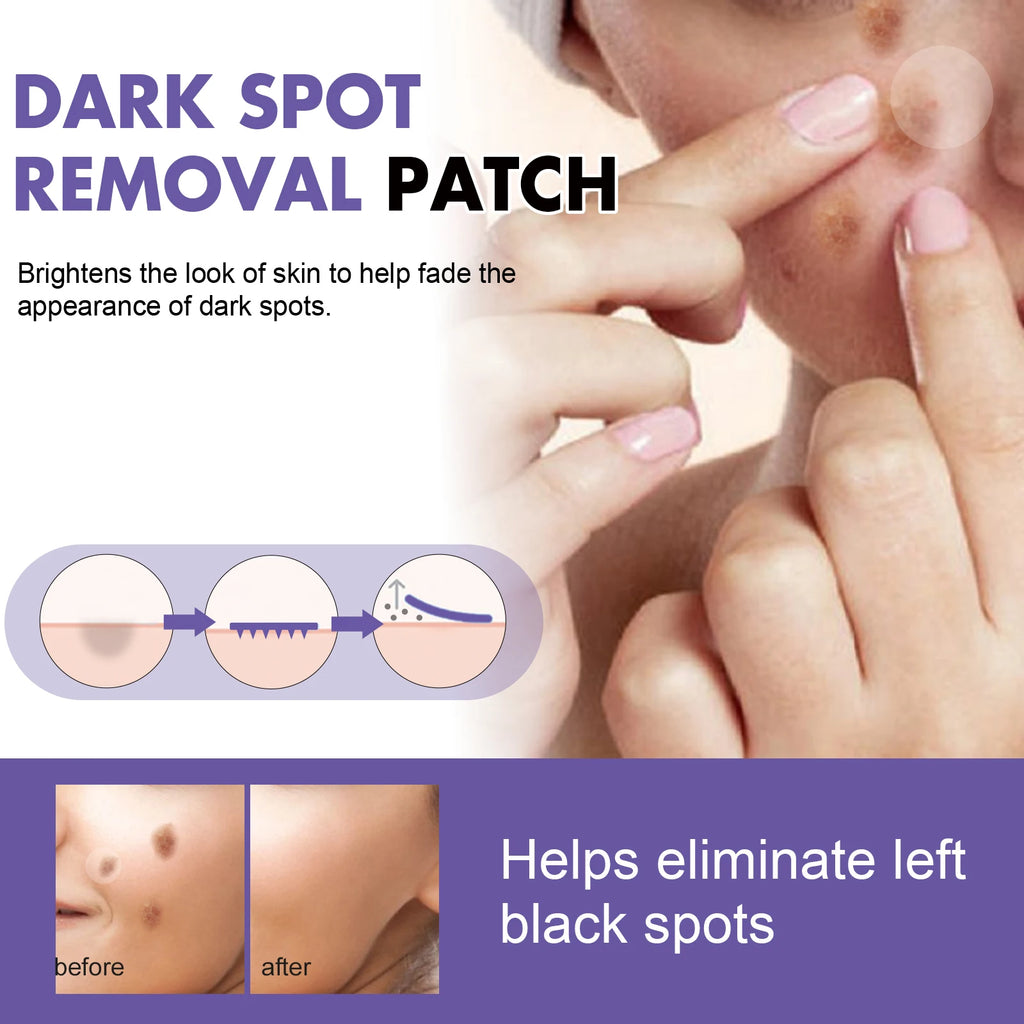 Eelhoe Dark Spot Patches 144pc – Pigmentation & Melanin Corrector