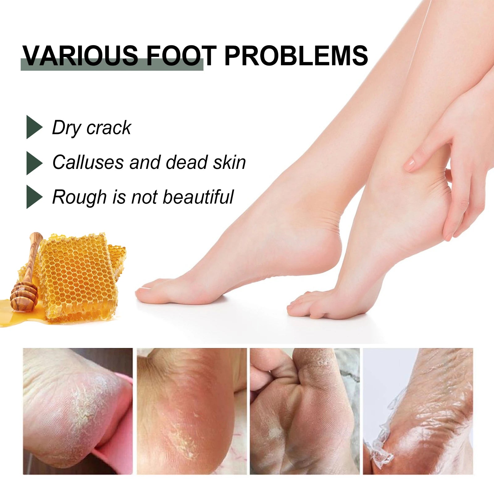 WOODSLEEP Cracked Heel & Hand Repair Cream – Deep Moisturizer Foot & Hand Cream Oasis Select