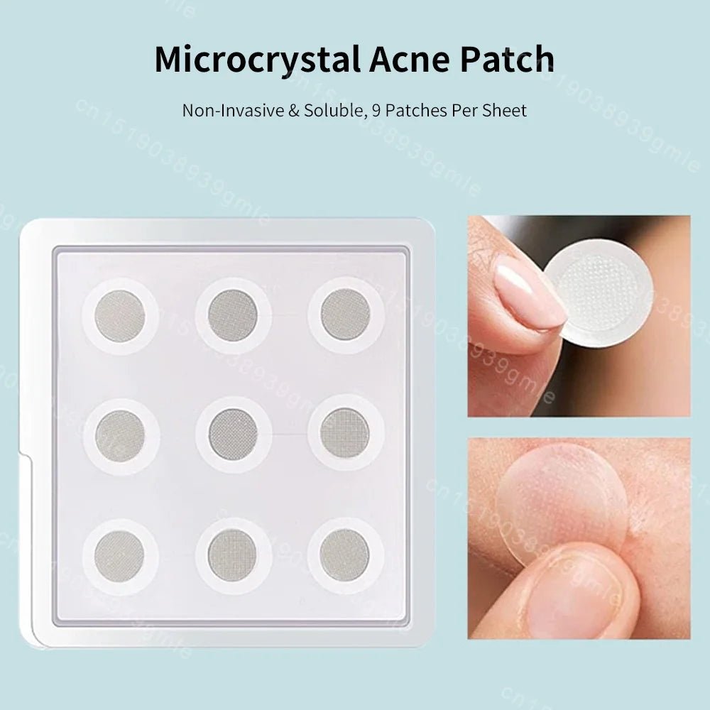 Hyaluronic Acid Microneedle Acne Patch – Invisible & Breathable