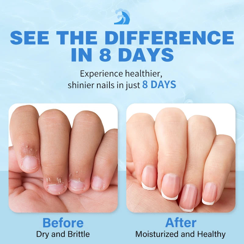 Ocean Breeze Cuticle Oil – Repairs & Strengthens Nails Overnight Cuticle Oil Treatment Oasis Select