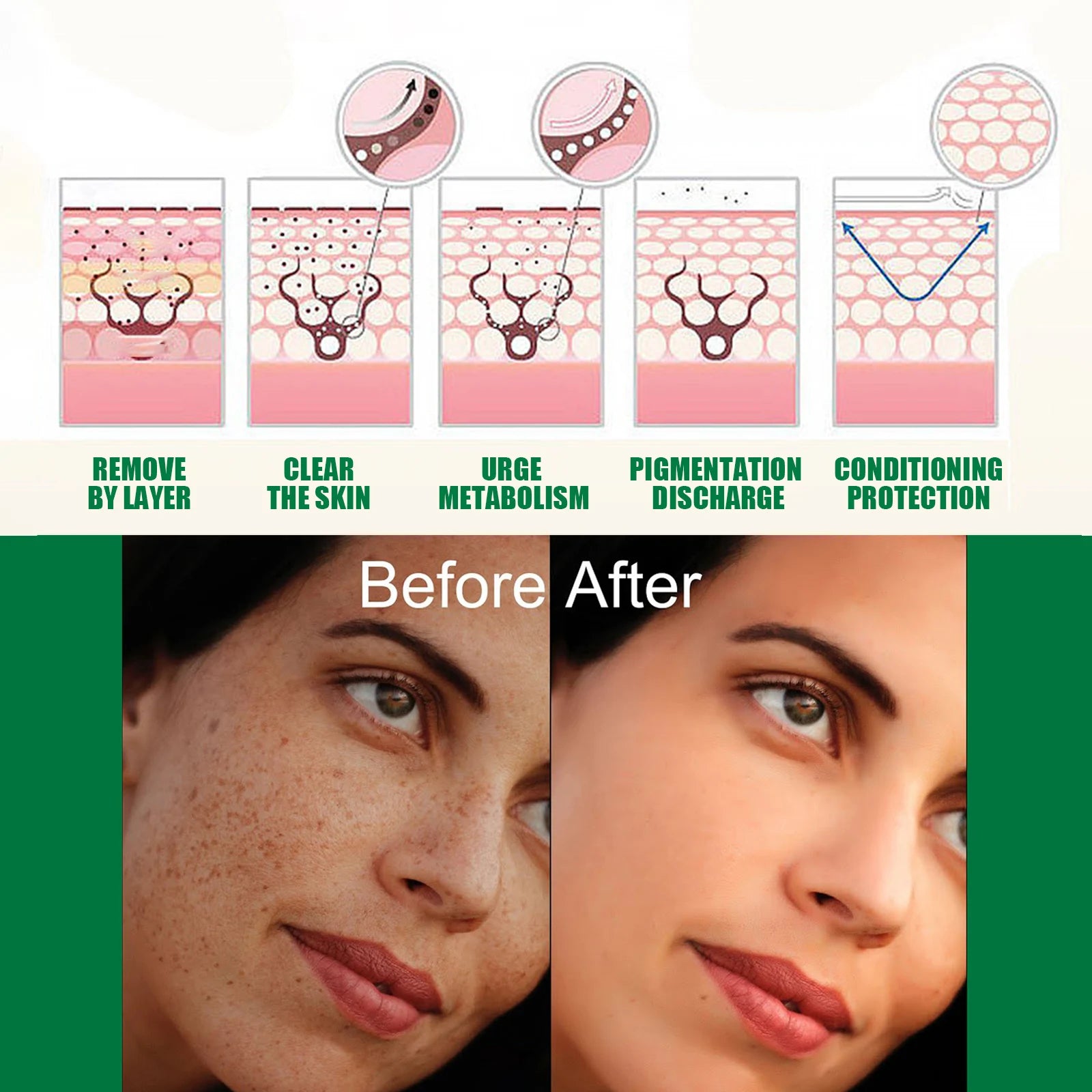 Eelhoe Melanin Correcting Serum – Brighten & Fade Freckles
