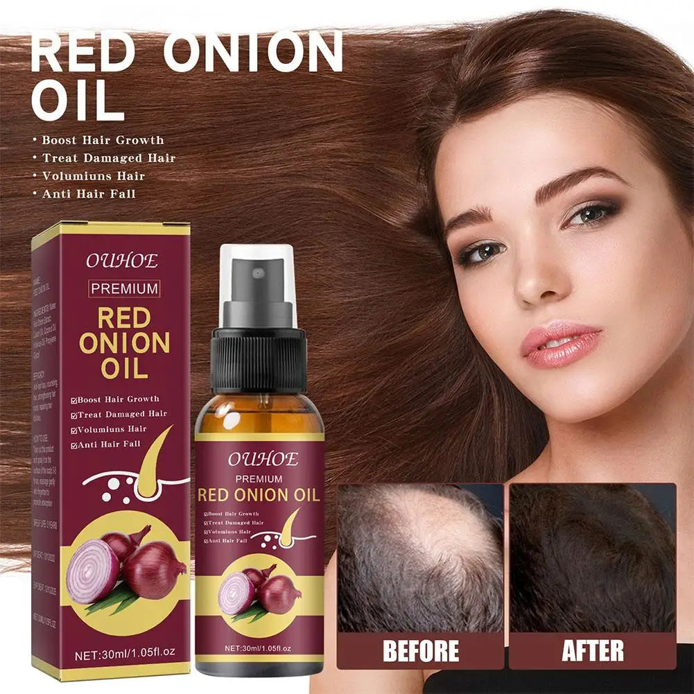 Red Onion Hair Oil Spray – Nourish Roots & Reduce Hair Loss