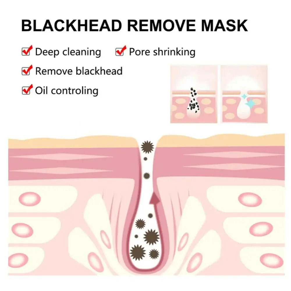 Peel-Off Blackhead Mask – Deep Cleanse, Oil Control 120g
