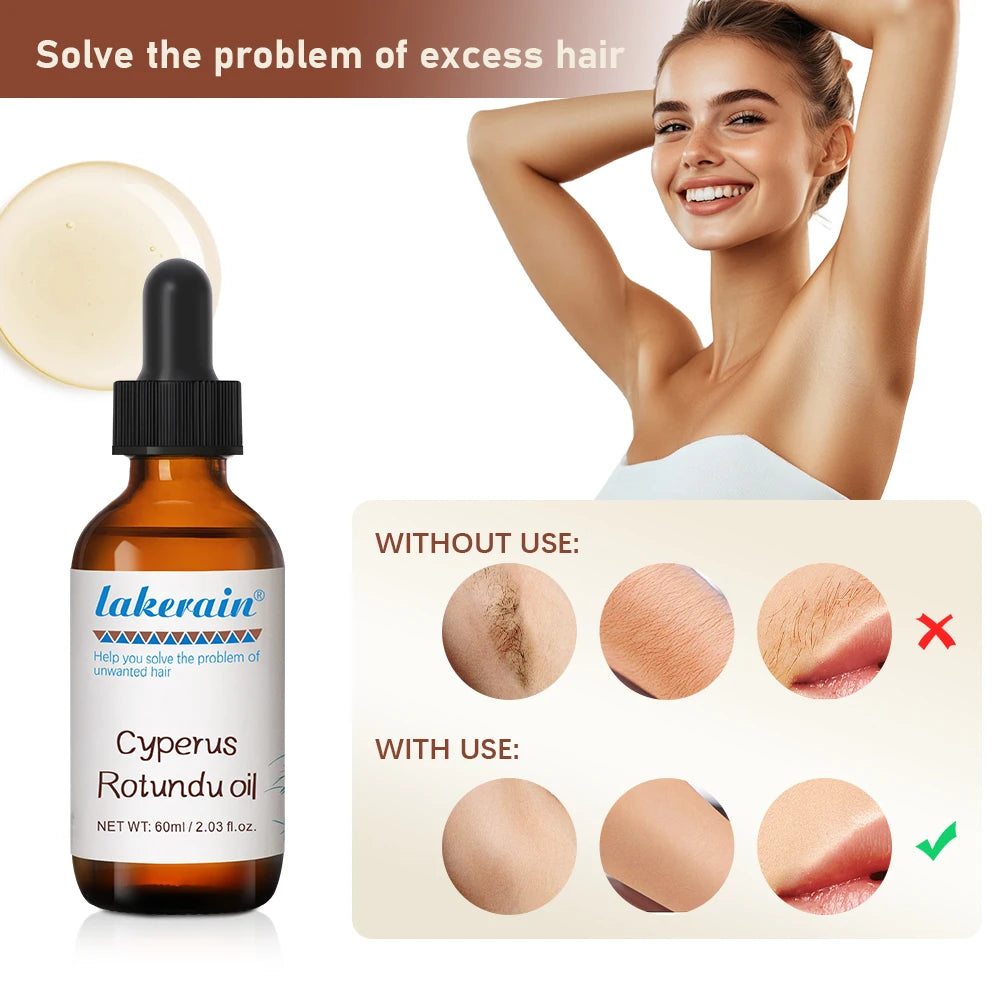 60ml Cyperus Rotundus Oil Nourish the Skin Ingredients are Safe Inhibit Hair Growth Wide Scope of Application Solve Hair Dense P Oasis Select