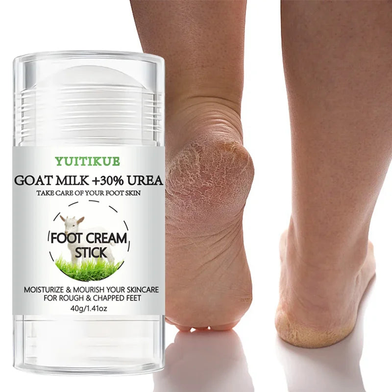 YUITIKUE 30% Urea & Goat Milk Foot Cream Stick – Dry Feet