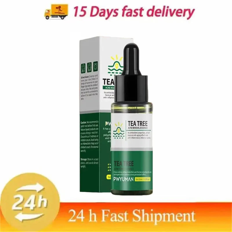 SADOER Salicylic Acid Acne Cream – Oil Control & Pore Minimizer Acne Face Cream Oasis Select 1pc 1