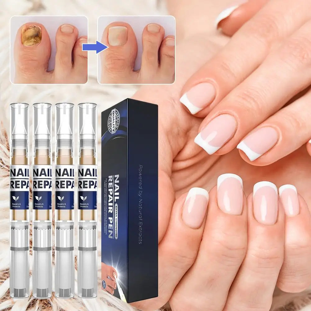 Nail Repair Essence Pen Set 4 Pcs – Undecylenic Acid Formula Nail Repair Pen Oasis Select