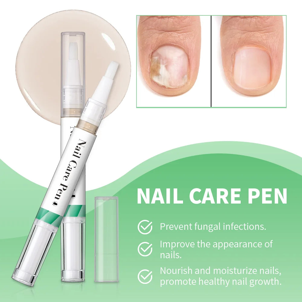 Nail Growth Oil Nail Treatment Cuticle Revitalizer Oil Prevent Agnail Nail Polish Nail Nutrition Oil Pen Manicure Nail Repair Oasis Select