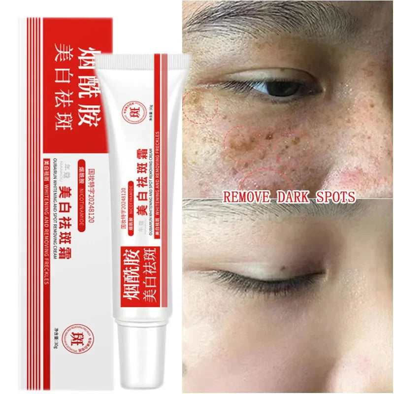 Niacinamide Brightening Cream – Fade Dark Spots 30g
