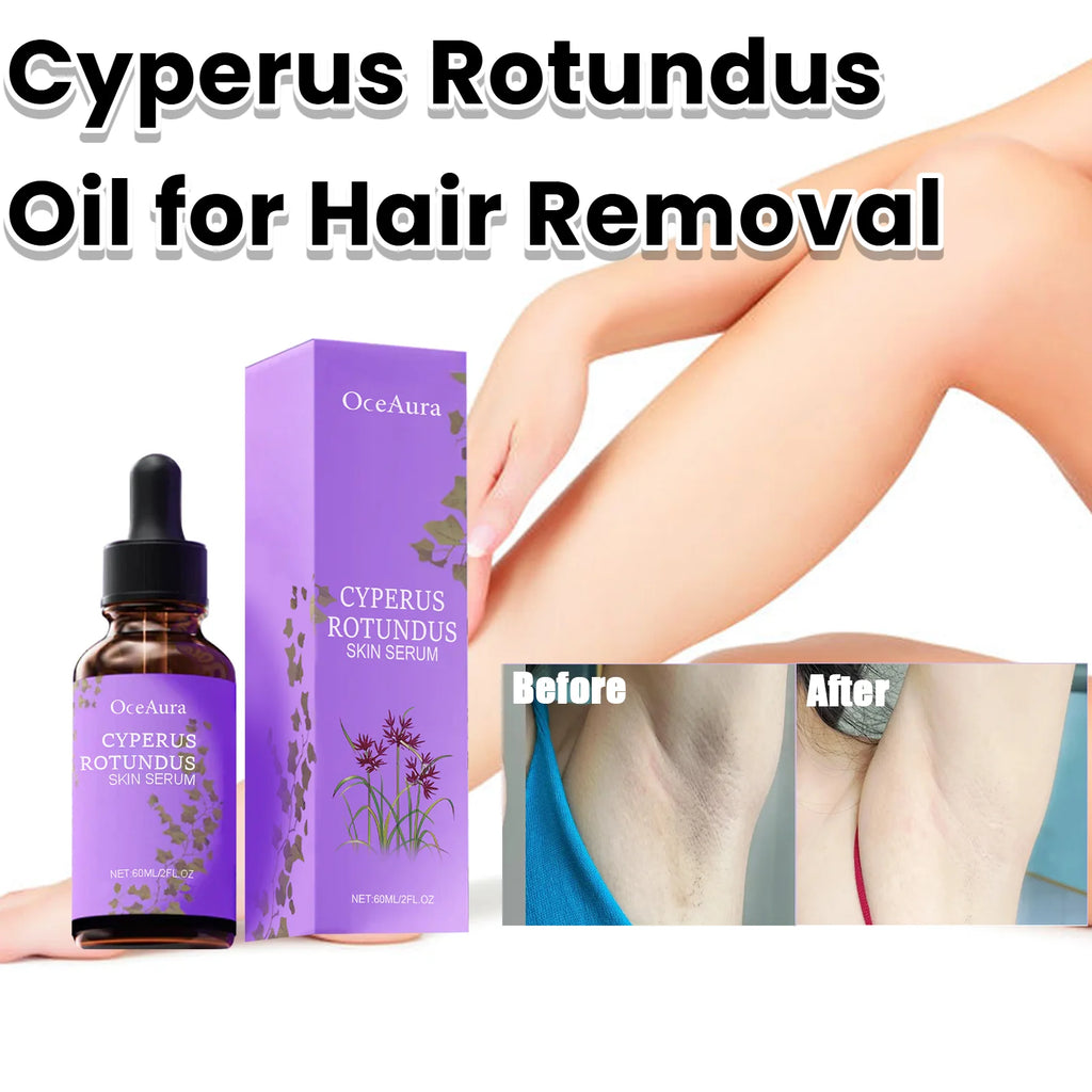 Cyperus Rotundus Skin Serum Natural Hair Removal Oil Women Body Hair Removal Liquid Hair Growth Inhibitor Non-Irritating Safe Oasis Select