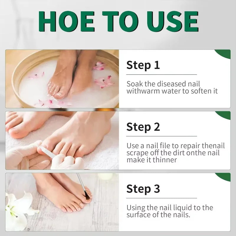 Ginger Nail Repair Serum – Restore Discolored & Uneven Nails Nail Treatment Serum Oasis Select