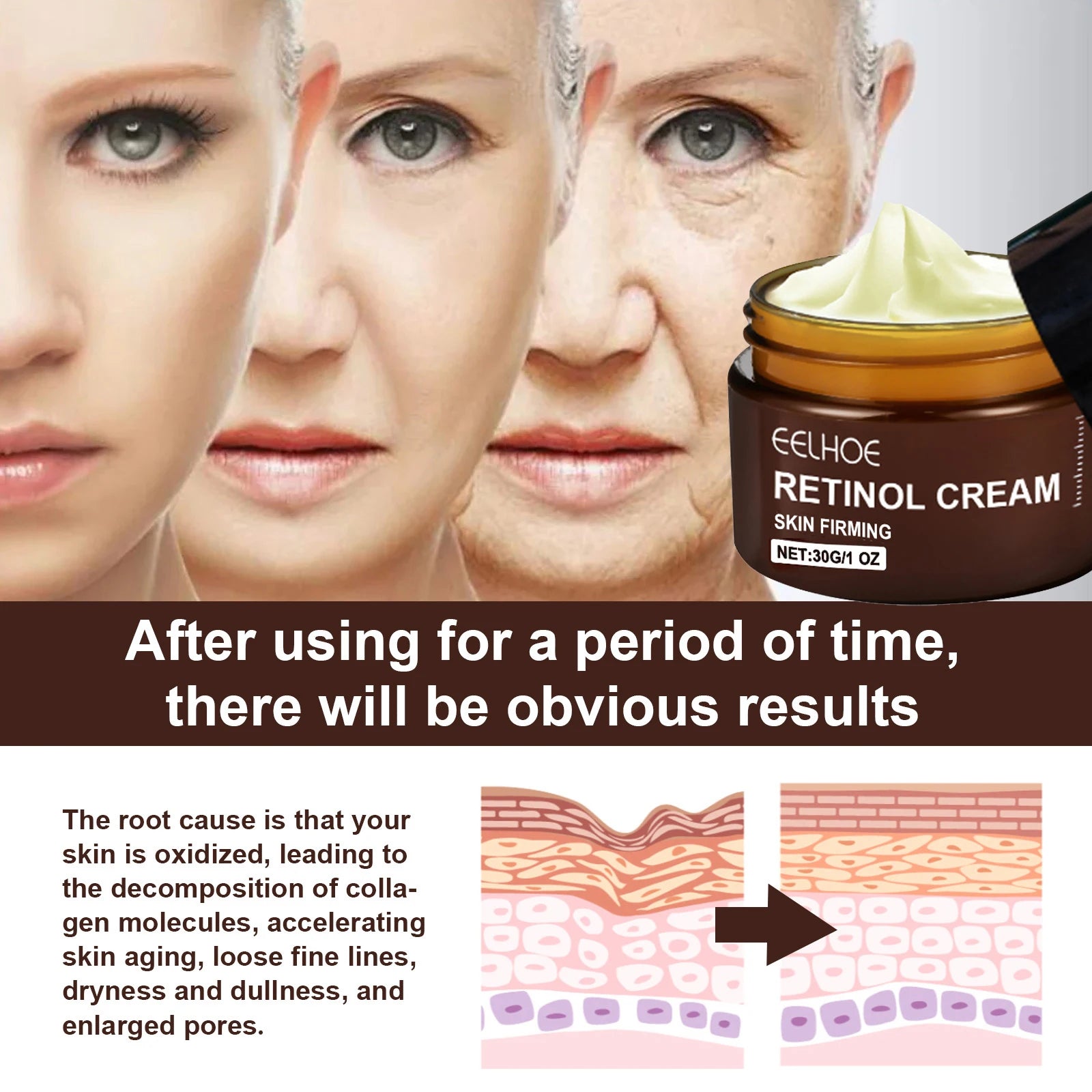 EELHOE Retinol Cream – Anti-Aging, Dark Spot & Brightening 30g