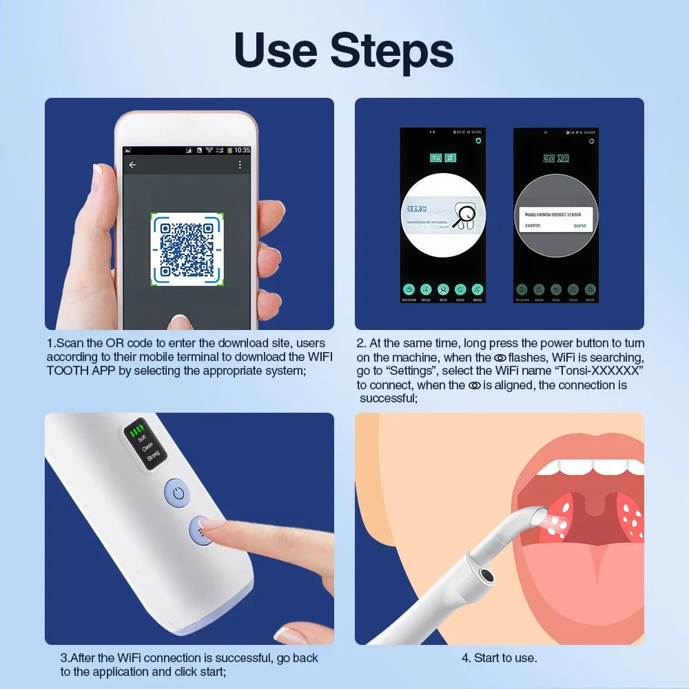 Electric Tonsil Stone Remover – 300K HD Camera & LED Light