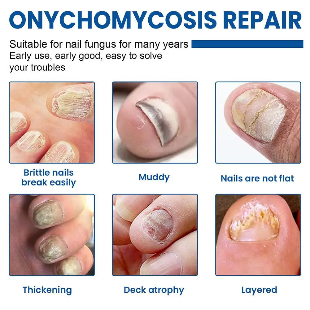 60pcs Toenail Patches Nail Repair Extra Strength Patches For Toenail Fingernail Non-Irritating And Breathable Nail Repair Oasis Select