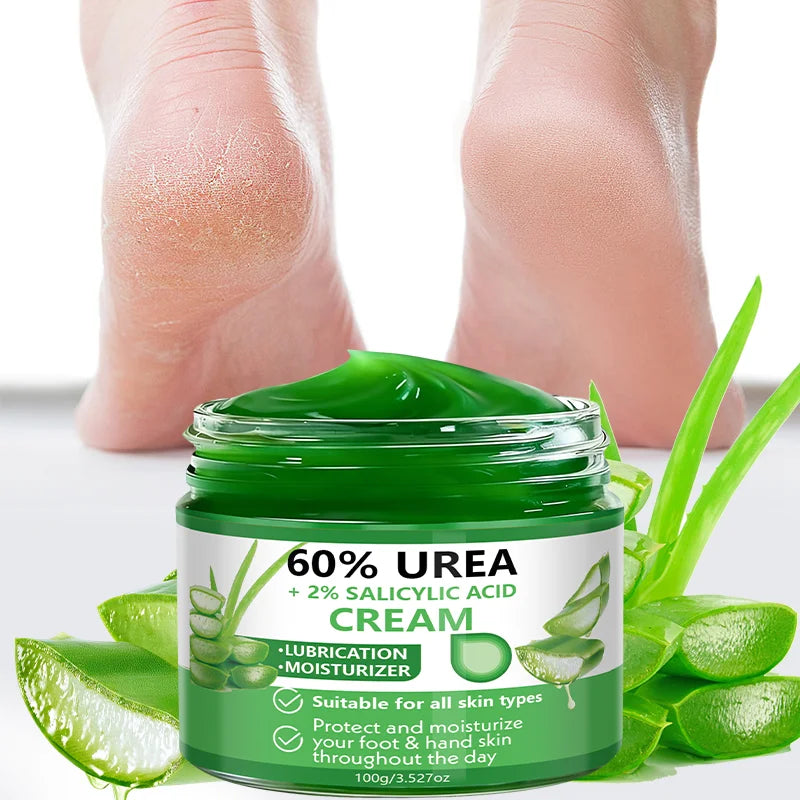 YUITIKUE 60% Urea Cream with Salicylic Acid – Feet & Hands