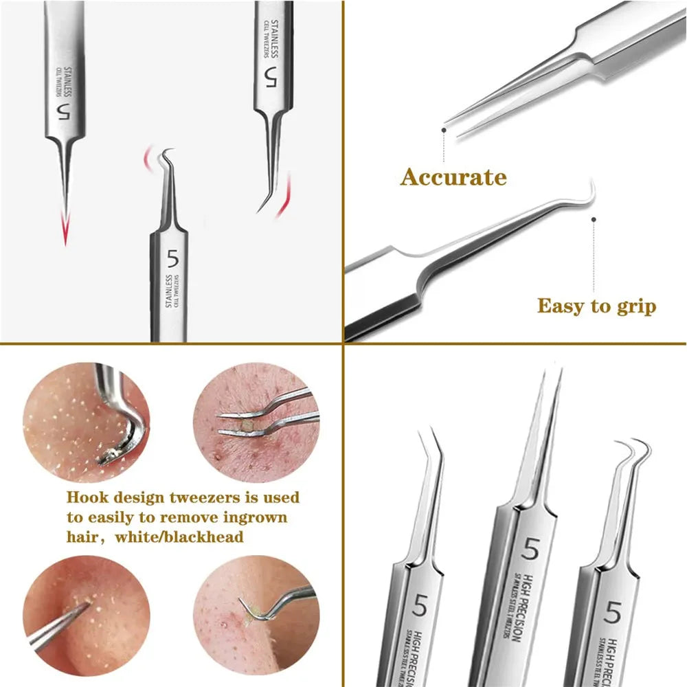 German Ultra-fine No. 5 Cell Pimples Blackhead Clip Tweezers Beauty Salon Special Scraping & Closing Artifact Acne Needle Tools Oasis Select