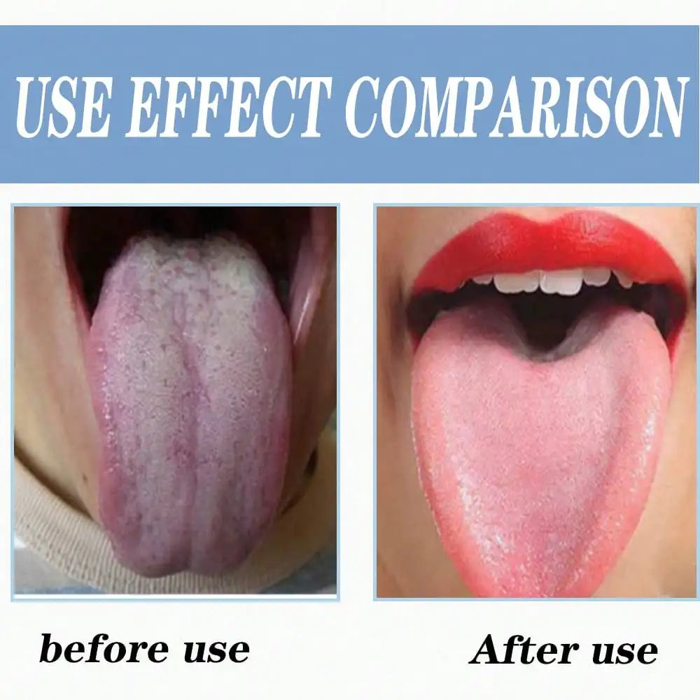 Tongue coating cleaner, stainless steel tongue scraper, oral cleaning tool 2pcs Oasis Select