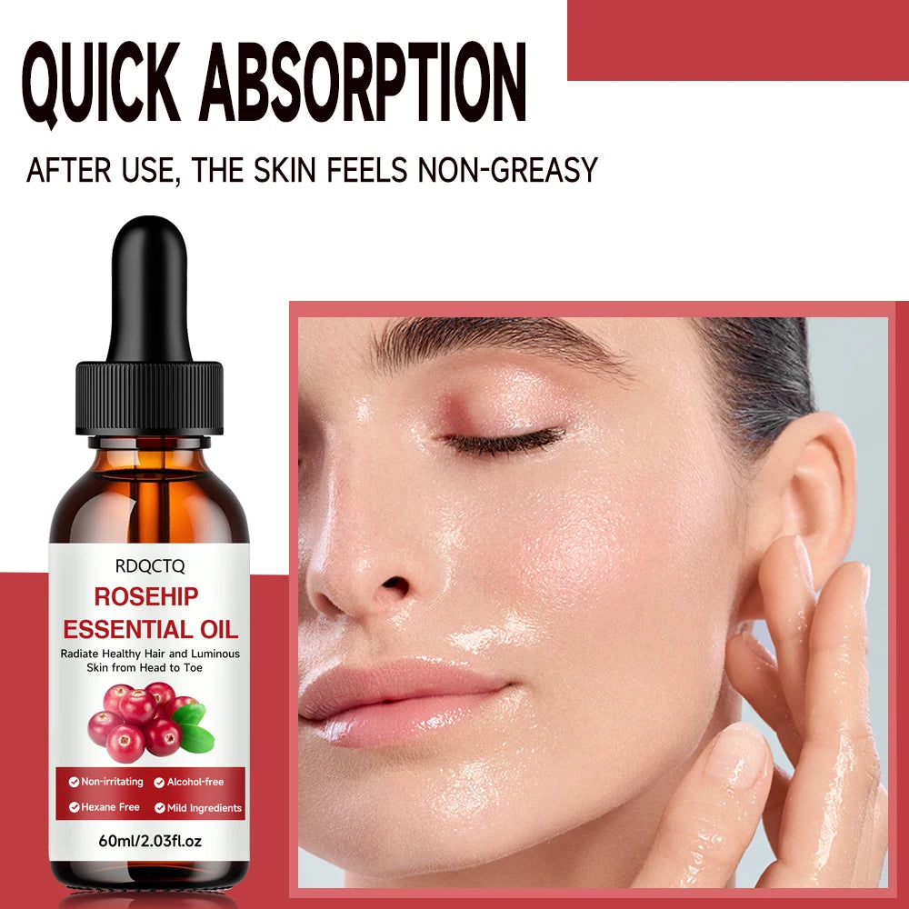 Rose Hip Oil for Hair & Skin - Pure Natural Moisturizing Essential Oil, Alcohol-Free, Nourishing Care for Healthy Look Oasis Select