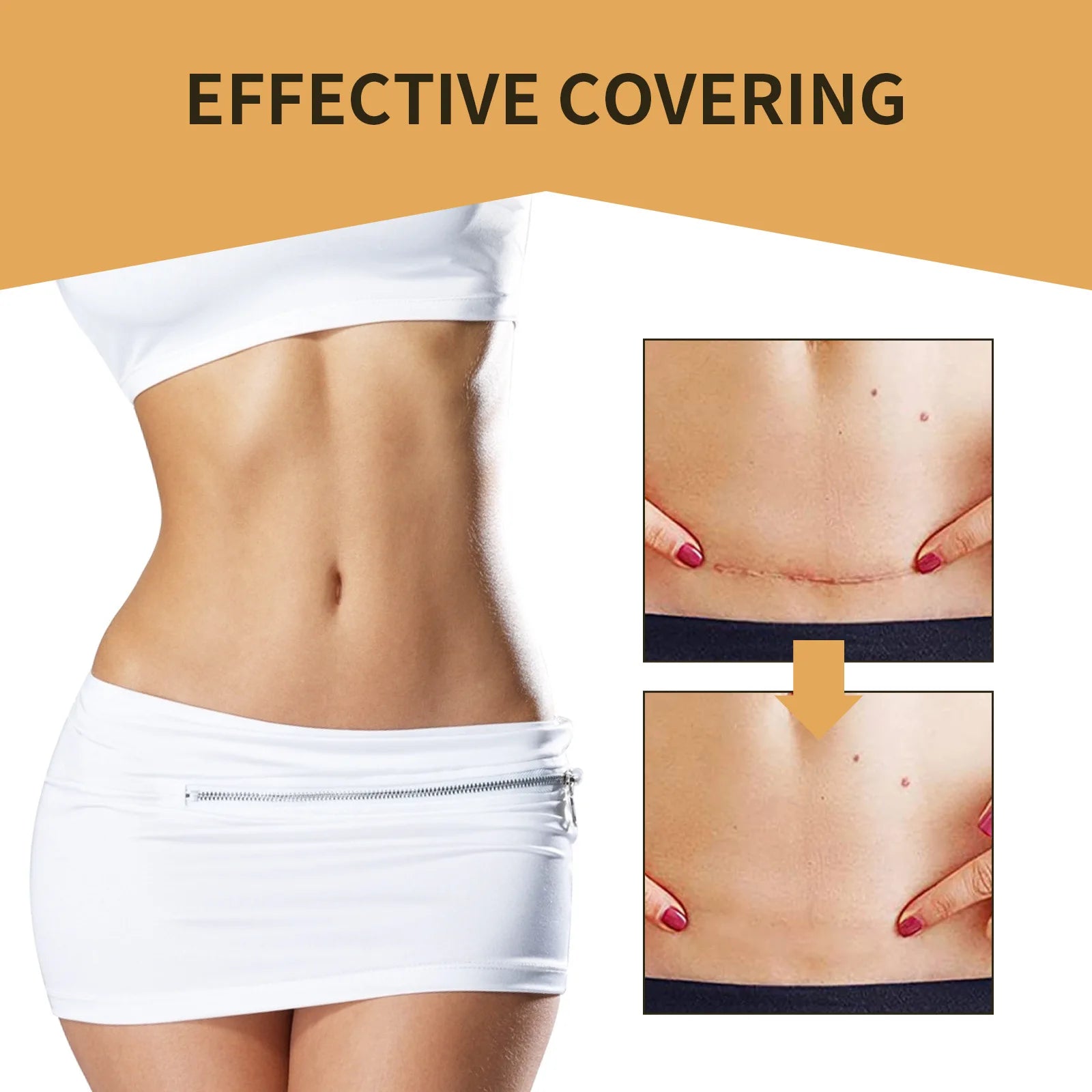 Jaysuing Concealer Patches – Waterproof Tattoo & Scar Cover 6pc