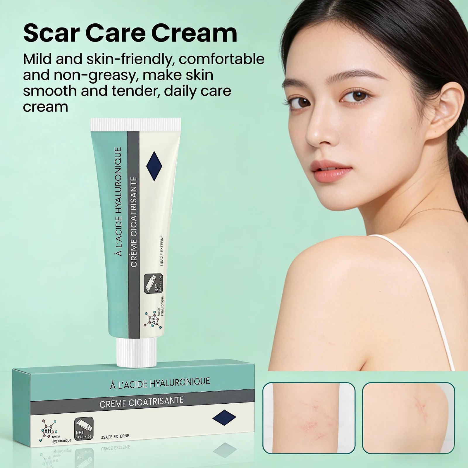 Scar Fading Cream Reduce Scars Improve Acne Marks Deep Hydration Repair Skin Moisturizing Scar Lightening Soothing Cream Oasis Select