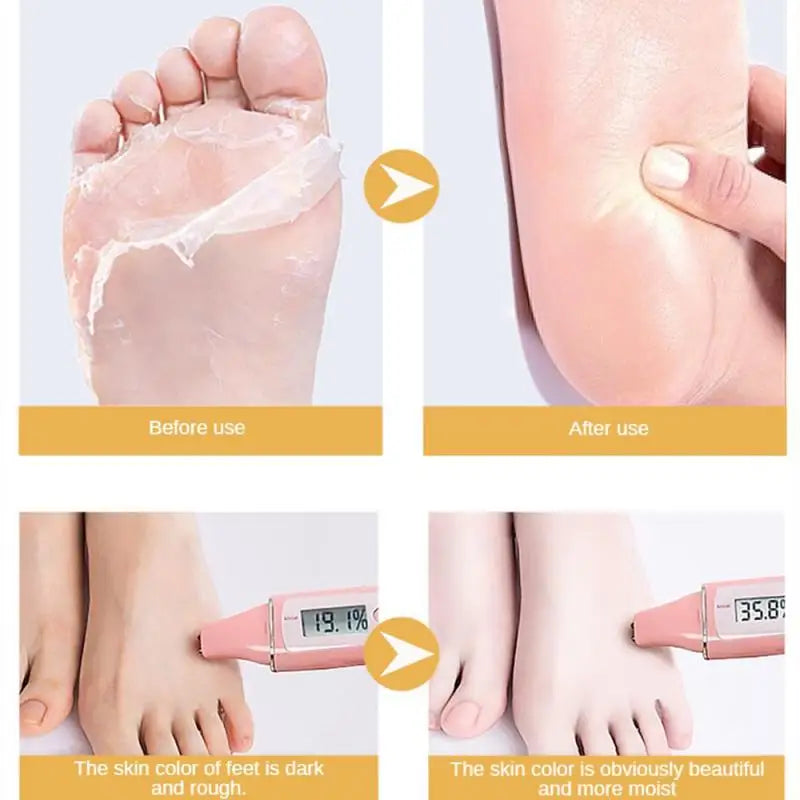 Goat Milk Exfoliating Foot Mask – Remove Dead Skin & Moisturize Exfoliating Foot Mask Oasis Select