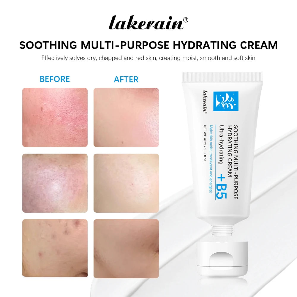 B5 Repair Cream Moisturizing Hydrating Effectively Solves Dry Chapped And Red Skin Nourishes Improve Repair Sunscreen Cream Oasis Select