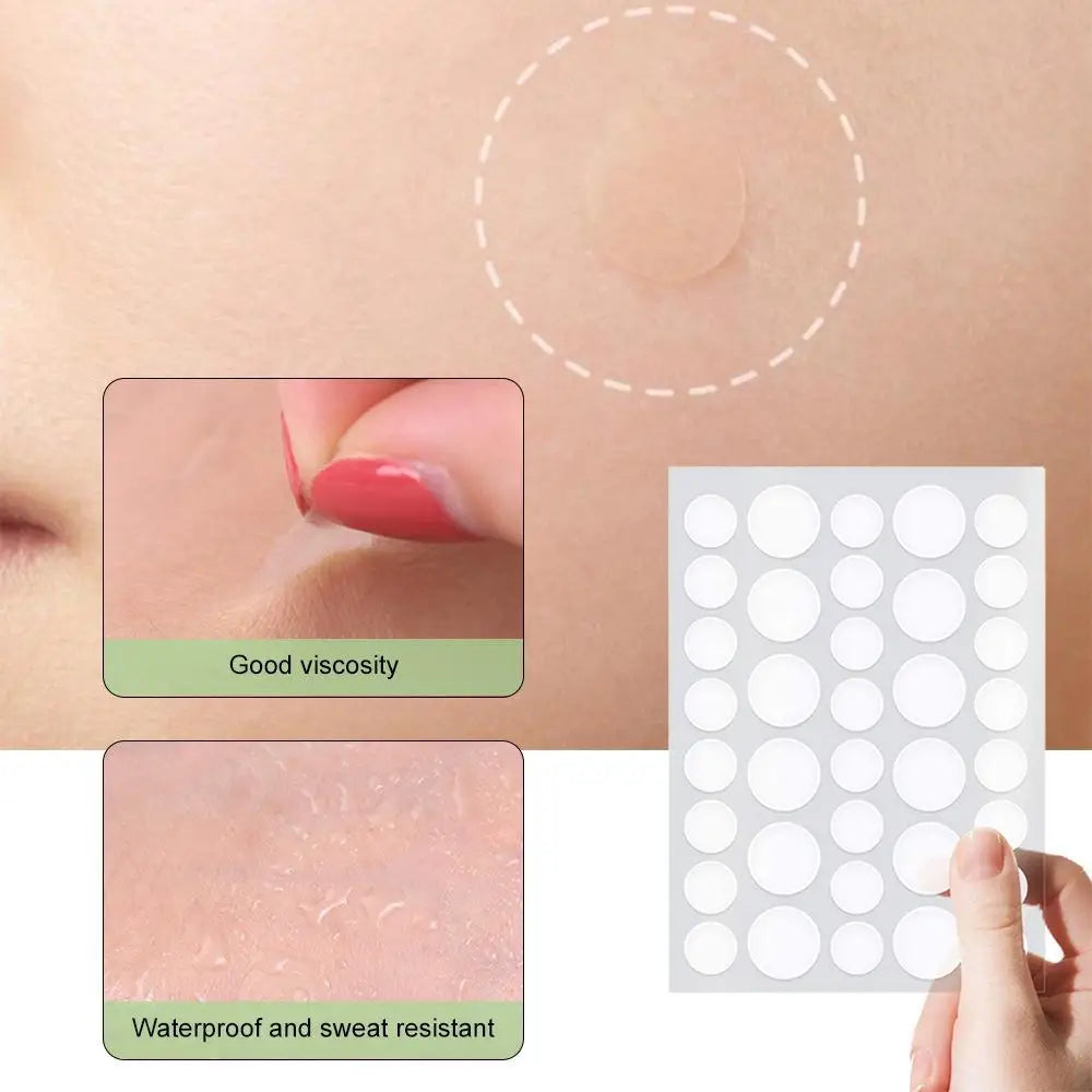 Invisible Pimple Patches with Tea Tree Oil – 72 or 288 Count Acne Pimple Patches Oasis Select