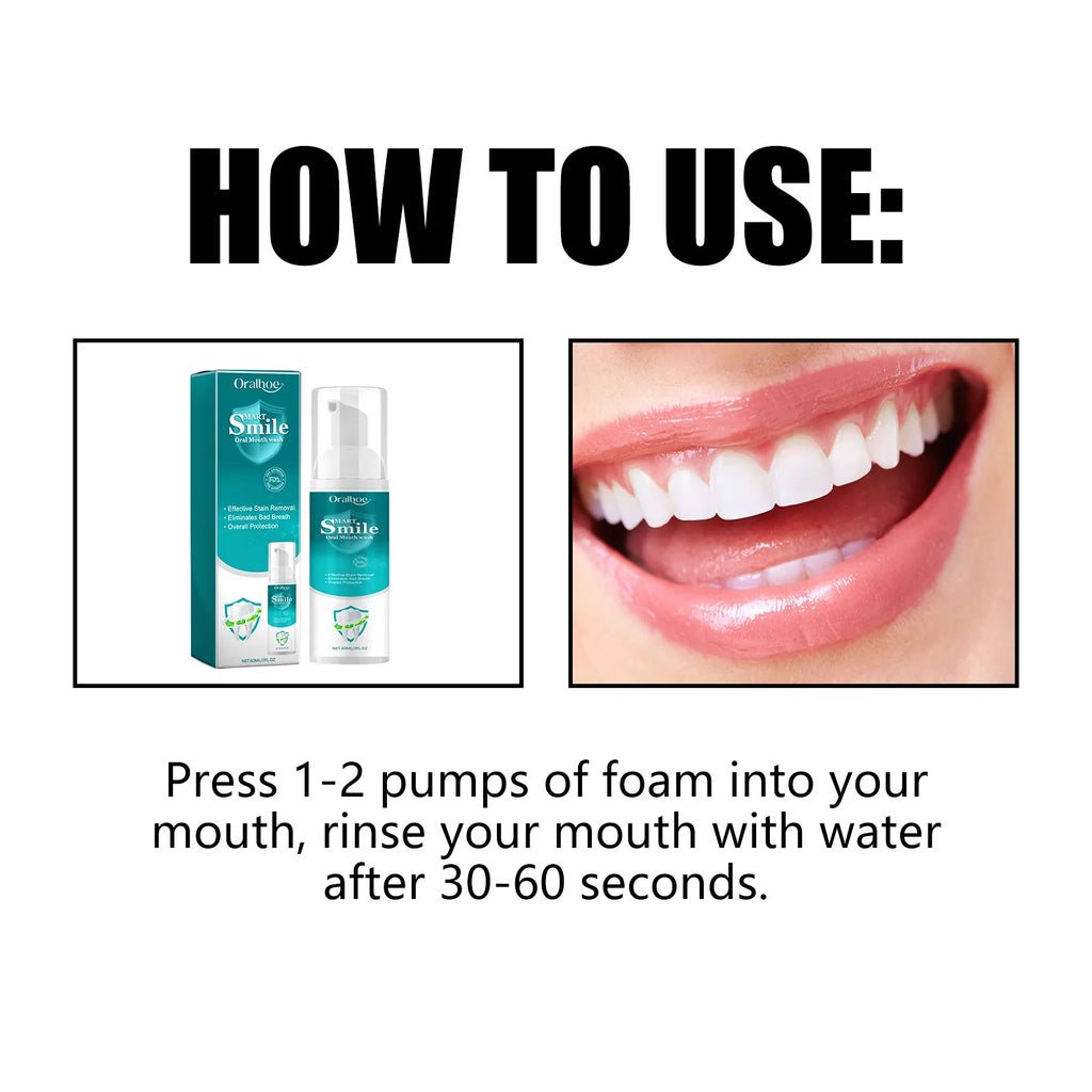 Oralhoe Propolis Oral Care Mousse Deep Clean Remove Yellowing Freshing Hygiene Keep Bleaching Teeth W-hitening Toothpaste Mousse Oasis Select