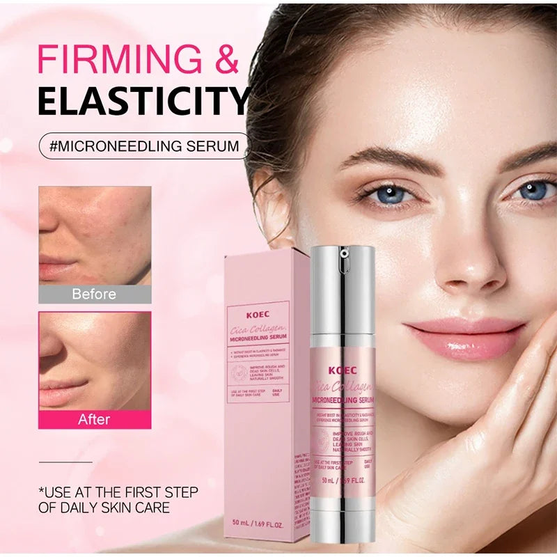 Centella Asiatica Microneedle Serum Deep Hydration Soothing Dragon Blood Serum Firm Brighten Repairing Facial Essence Oasis Select