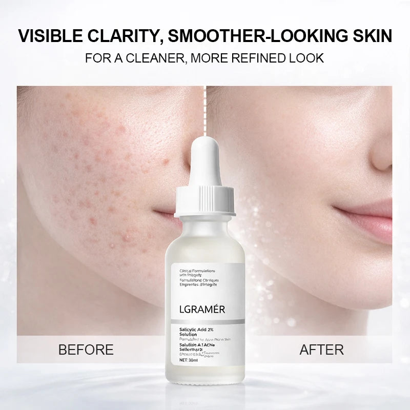 LGRAMER 2% Salicylic Acid Serum – Pore Cleansing 30ml