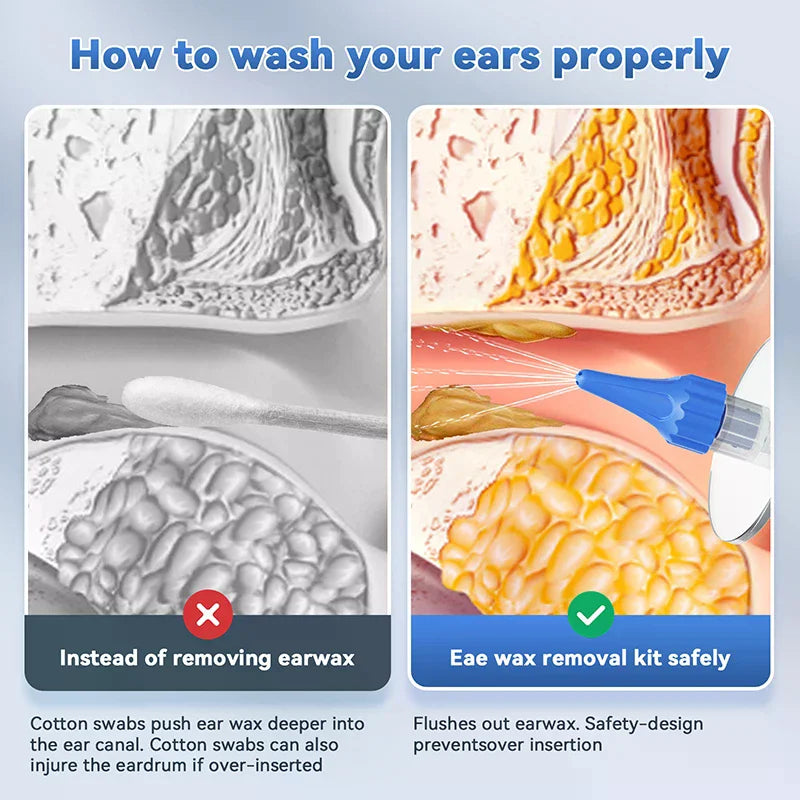 Ear Wax Removal Tool Manual Ear Irrigation Flushing System Safe And Effective Ear Cleaner For Adults Kids Cleaning Washer Kit Oasis Select