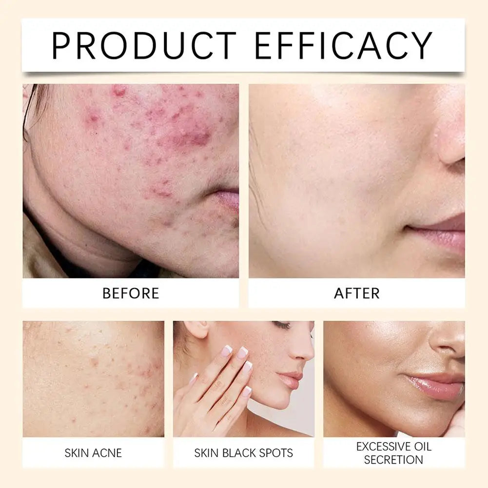 100ml Deep Moisturizing Soothing Face Spray – All Skin Types Facial Mist Spray Oasis Select