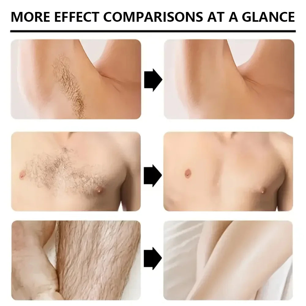 YUITIKUE Men's Hair Removal Cream 100g – Mild Full Body