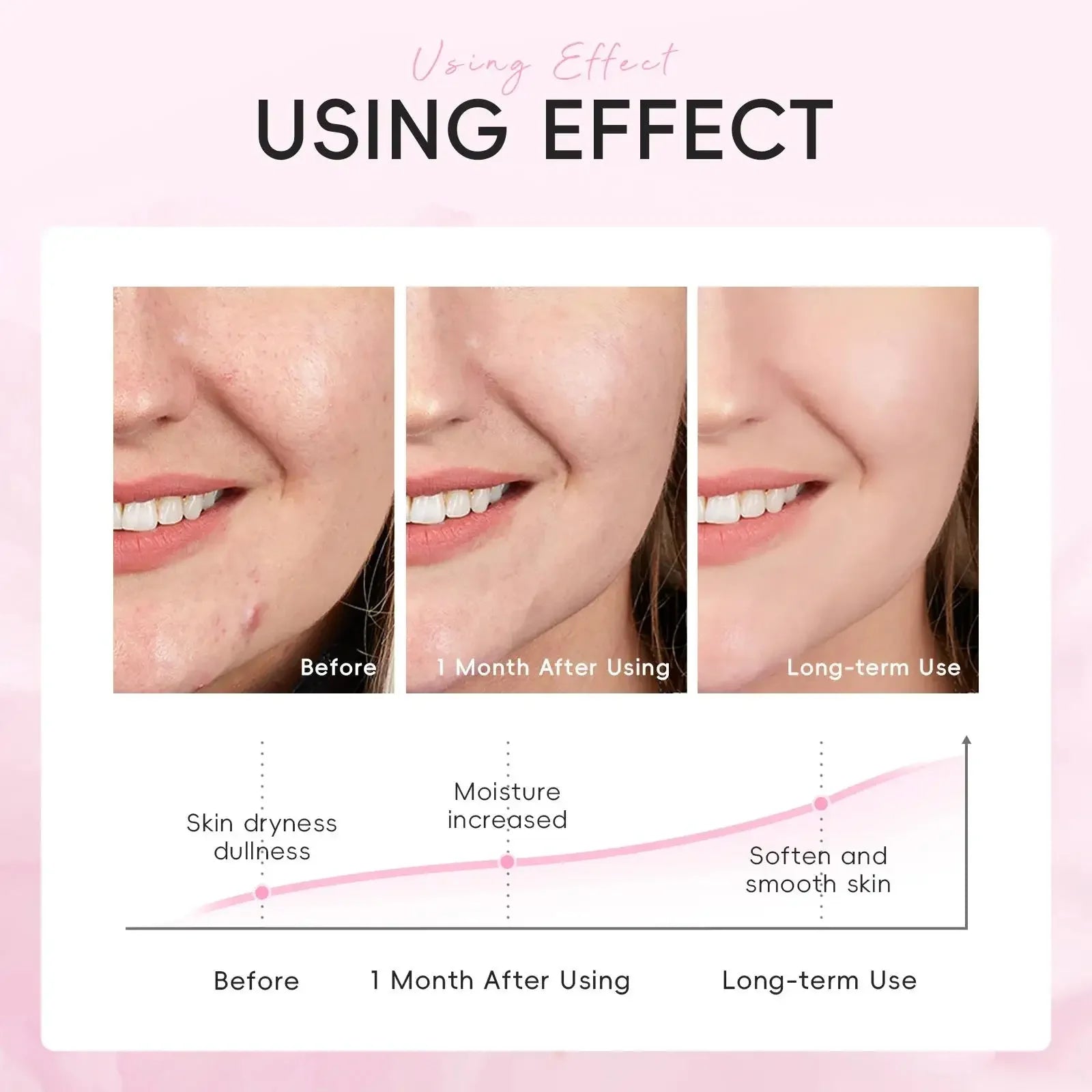 LAIKOU Sakura Moisturizing Face Mask – 10 Pack | Hydrating