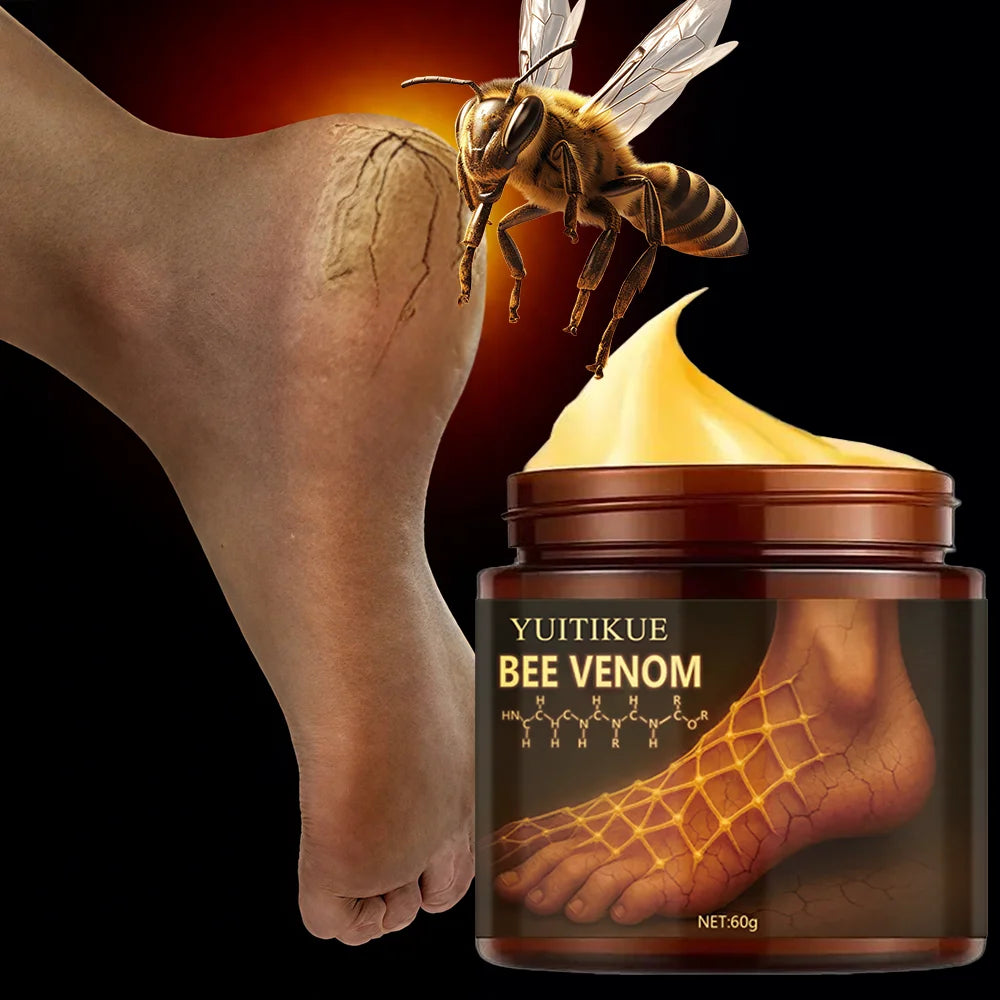 Urea Foot Cream 100g – Dry Heels, Hands & Elbows Relief