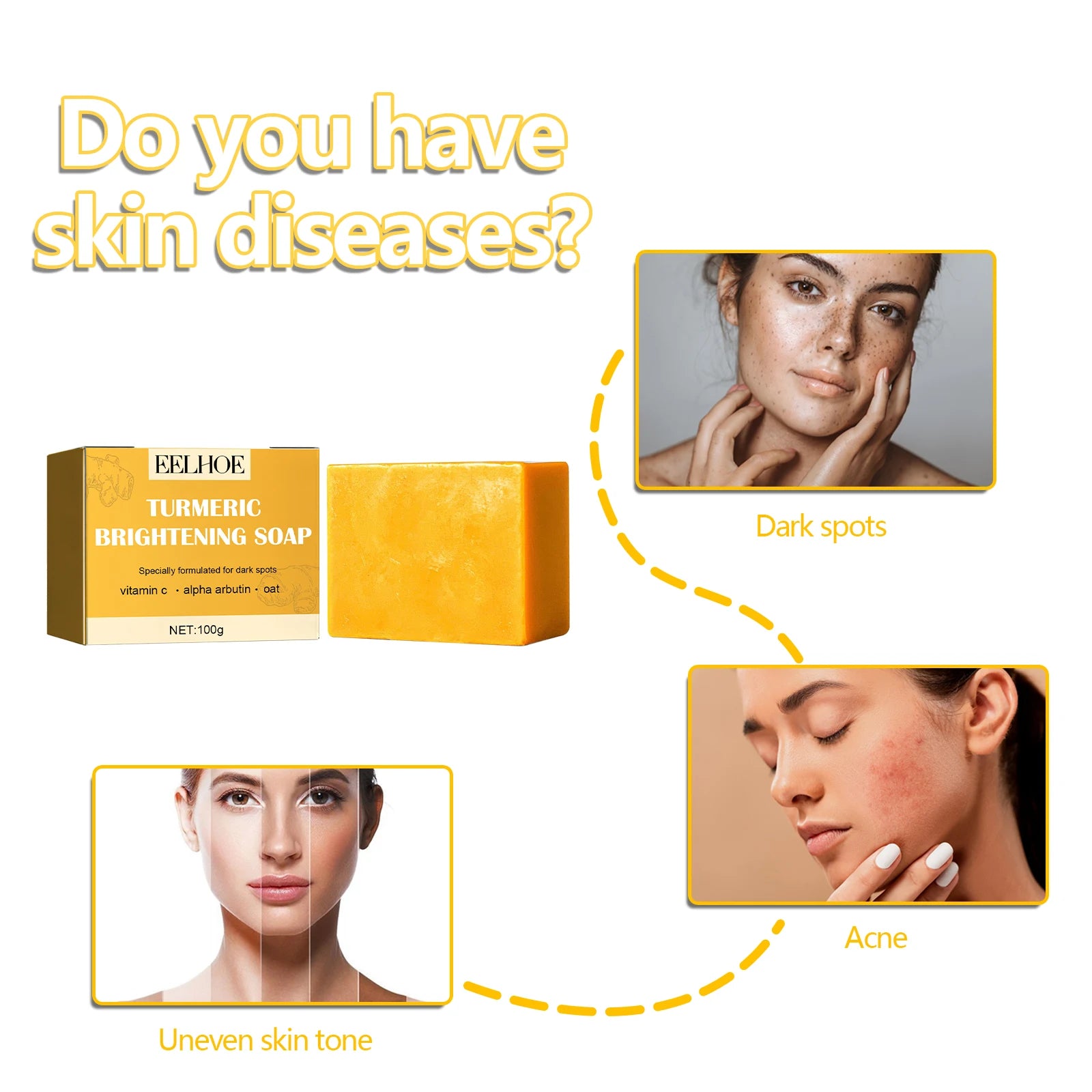 Eelhoe Turmeric Face Soap – Brighten Skin & Fade Dark Spots Facial Cleansing Soap Oasis Select
