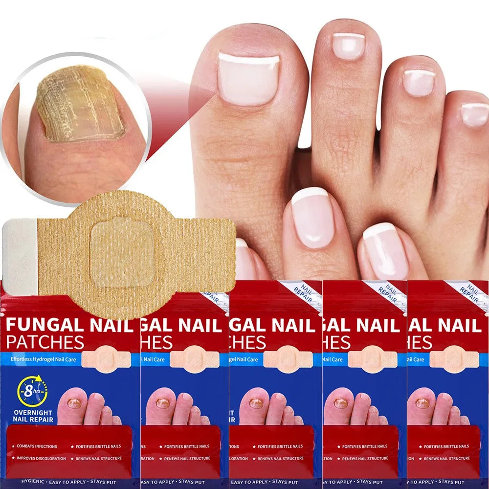 Nail Repair Patches – Ingrown Toenail & Nail Care Stickers Nail Care Patches Oasis Select