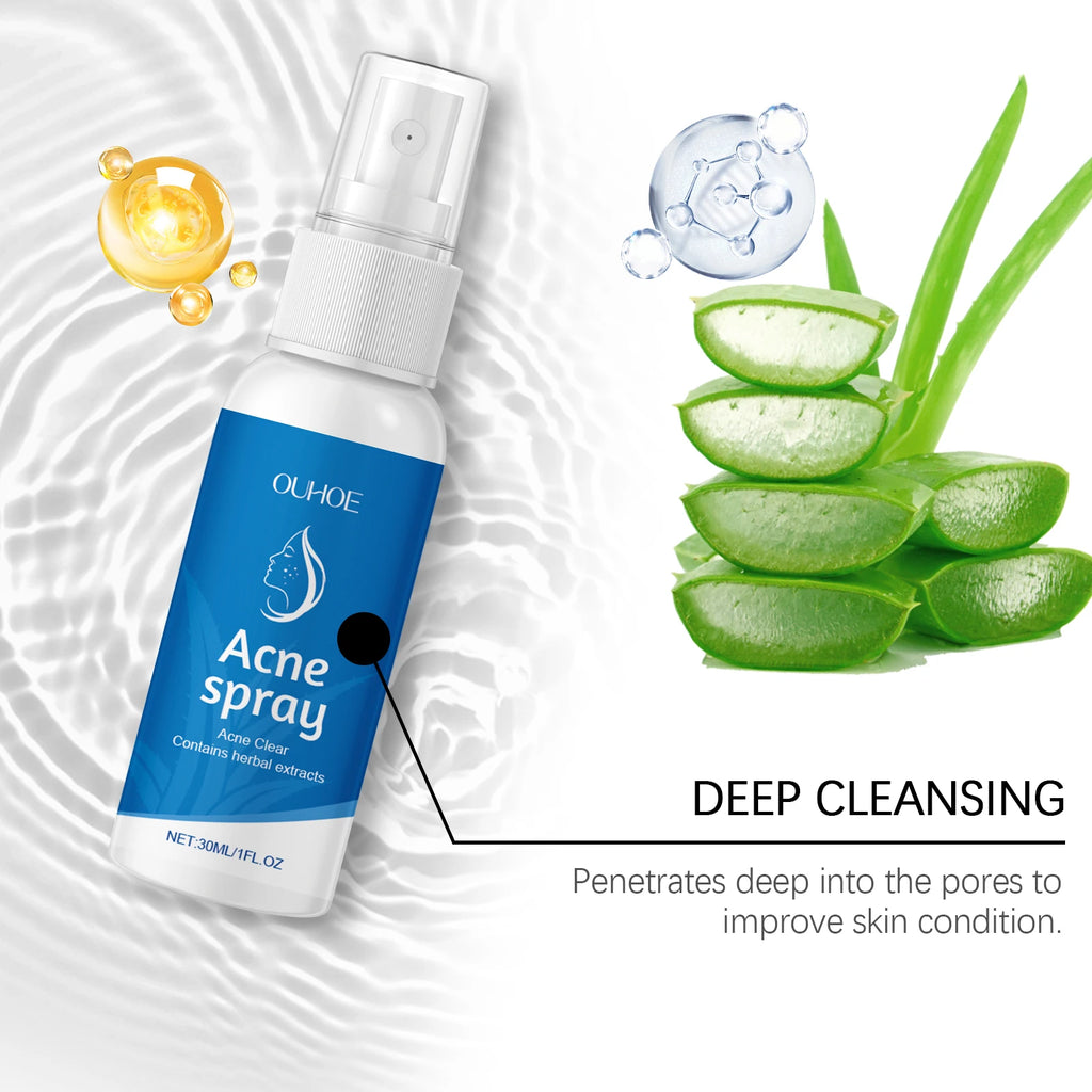 30ML Herbal Soothing Face Spray Deep Nourishing Relief Discomfort Reduce Reness Moisturizing Refreshing Face Acne Care Spray Oasis Select