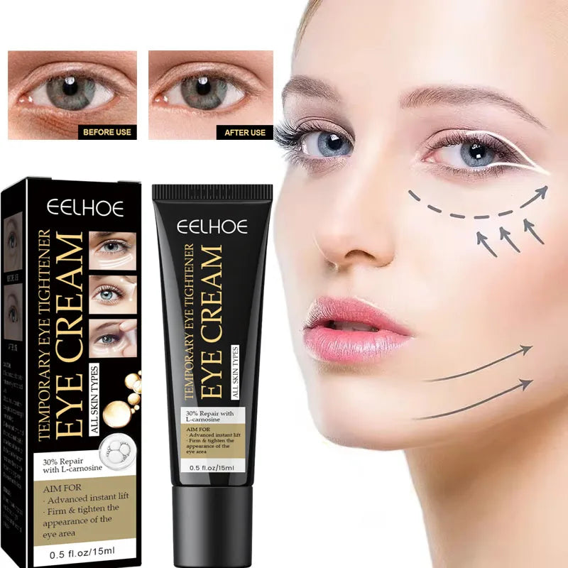 Retinol Eye Cream – Firming, Dark Circle & Hydrating 15ml Eye Cream Oasis Select 1pc