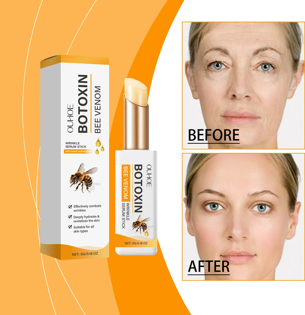 Anti wrinkle eye ointment is used for dark circles, eye bags, and puffiness Oasis Select