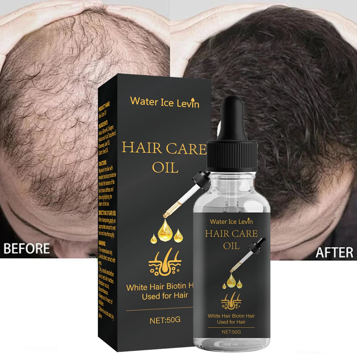Biotin Hair Oil – Rosemary, Castor Oil & Collagen for Shine Hair Treatment Oil Oasis Select